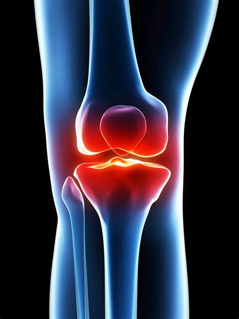 Knee pain .